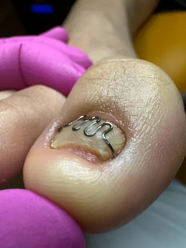 Podolog Warszawa Weronika Piuta "Innowacja Stóp"